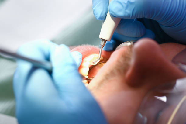 Best Emergency TMJ Treatment in Chalfont, PA