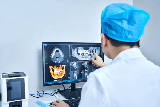 Best Emergency Wisdom Teeth Removal in Chalfont, PA
